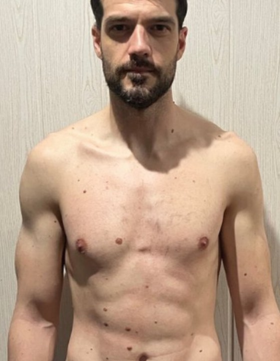 Rubén después de 4 semanas en Naga